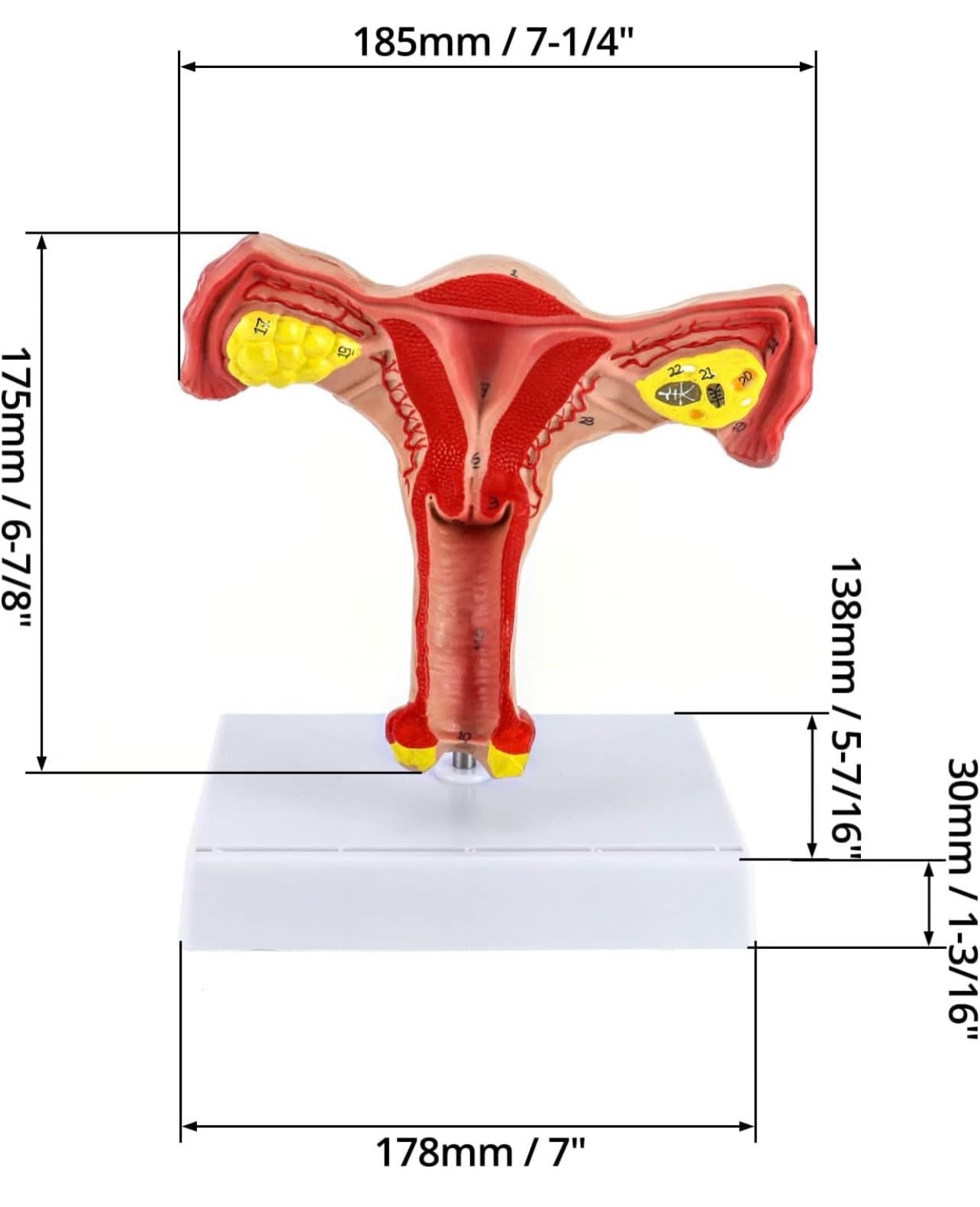 Modelo anatómico Sistema reproductor femenino